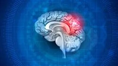 هل يحدث ارتجاج المخ للرضع؟