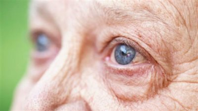 ماذا يرى مريض التنكس البقعي الجاف؟