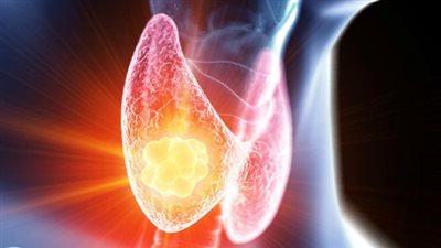 وزارة الصحة المصرية تكشف أهمية تحليل قصور الغدة الدرقية