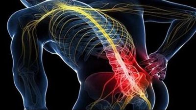 أسباب ألم العصب الوركي.. عوامل خطر وأعراض عرق النسا