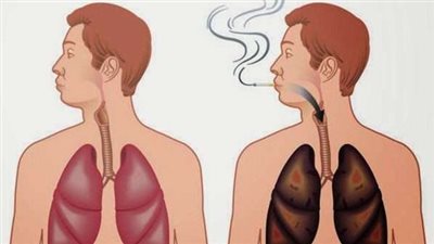 تنظيف الرئتين من أضرار التدخين.. 8 خطوات طبيعية دون أدوية