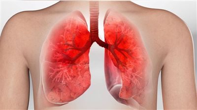 علاج التهاب الشعب الهوائية في فصل الخريف بـ 4 خطوات فقط