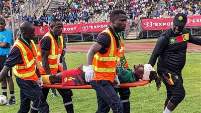 بعد تعرضه لإصابة خطيرة في الرأس.. تطورات الحالة الصحية للاعب الكاميرون