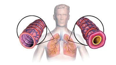 سبب صفير التنفس أثناء النوم.. 12 سببًا لهذه الحالة المزعجة