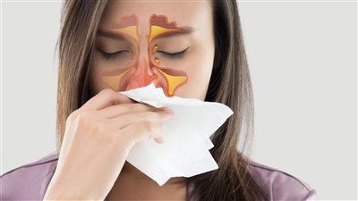 ما هي أعراض التهاب الأنف والأذن والحنجرة؟.. 3 معلومات مهمة