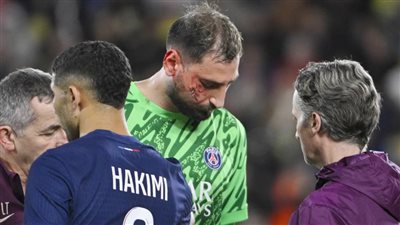 دوناروما يوجه رسالة بعد إصابته المروعة (صور)