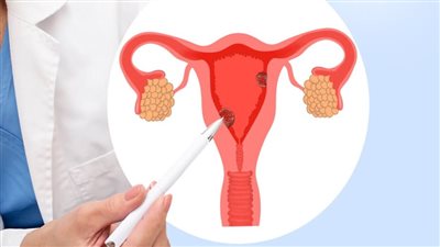 7 معلومات عن بطانة الرحم الطبيعية.. اعرفي سُمكها المناسب للحمل