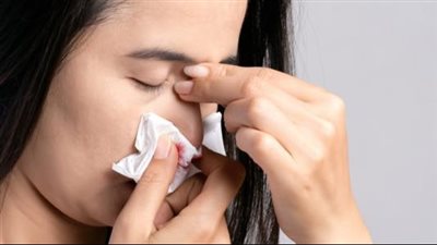 متى يكون نزيف الأنف خطير؟.. انتبه لـ 6 علامات رئيسية