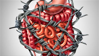 أسباب الإمساك المزمن.. عوامل حياتية محفزة وأخرى مرضية محتملة