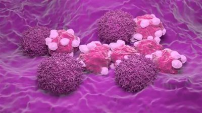  الصحة المصرية تكشف كيف يتم الوقاية من سرطان عنق الرحم بنسبة 100%؟