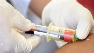 مدير منظمة الصحة العالمية: طرح حقن جديدة للإيدز كل 6 أشهر تمنع الإصابة بالفيروس