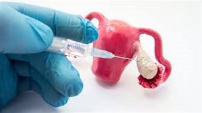 هل التنشيط يؤثر على مخزون البويضات.. تعرفي على مستويات هرمون AMH