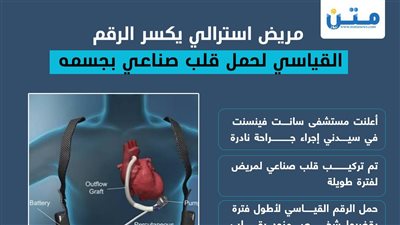 مريض استرالي يكسر الرقم القياسي لحمل قلب صناعي بجسمه (إنفوجراف)