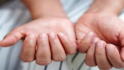 أعراض انخفاض مستويات الفيريتين