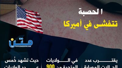 الحصبة تتفشى في أميركا (فيديوجراف)