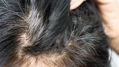 نصائح هامة للحفاظ على صحة الشعر وتأخير ظهور الشيب