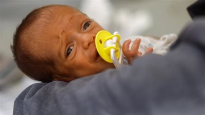 غزة: 326 وفاة و300 حالة إجهاض بسبب سوء التغذية خلال 80 يوما