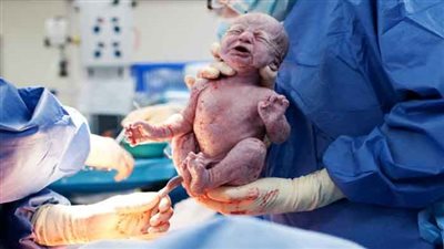 مراحل الولادة الطبيعية وأهم شروطها.. تعرفي عليها بالتفصيل