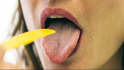 أسباب اللسان الأبيض وكيفية التخلص منه طبيعيًا