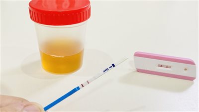 كيفية إجراء اختبار الحمل.. اعرفي الطريقة والتوقيت المناسب 