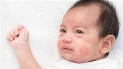 ما هو التهاب السحايا؟