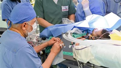 نجاح عملية فصل التوأم السيامي السعودي 