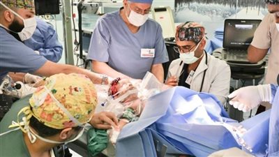  من هما يارا ولارا؟.. تفاصيل العملية: 38 طبيبًا و9 مراحل دقيقة