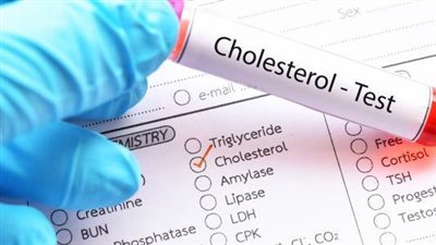 اختبار الكوليسترول.. تعرف على دواعي إجرائه 