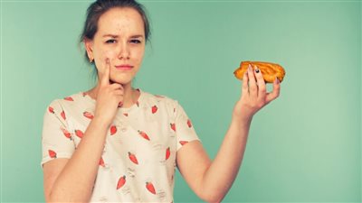 9 أطعمة تسبب حب الشباب.. يجب تقليلها