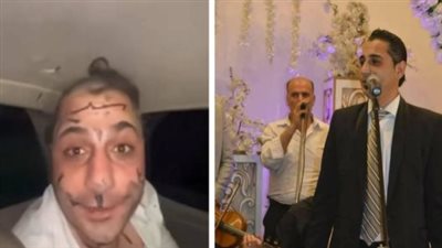 من هو عمر خيري؟ ولماذا تعرّض للضرب والإهانة أثناء حفل زفاف؟