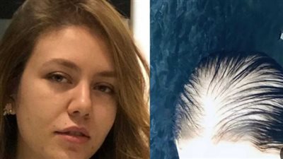 من النجومية إلى المعاناة.. الفنانة رحمة حسن تروي تفاصيل فقدان شعرها بالكامل