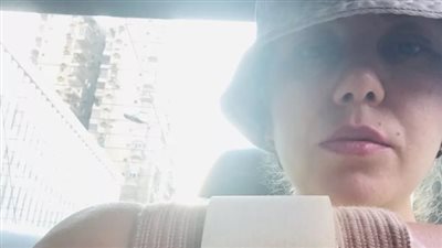 رحمة حسن تكشف عن إصابتها في الذراع وأزمتها مع سقوط الشعر