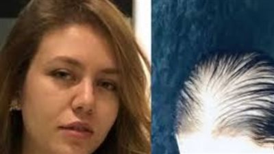 من الذراع إلى الشعر.. معاناة رحمة حسن تثير قلق جمهورها على إنستجرام