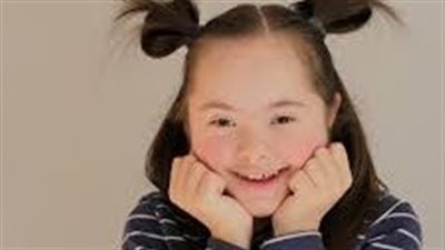 متلازمة داون.. تعرفي على الأعراض والأسباب بالتفصيل