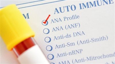 اختبار المناعة الذاتية.. التشخيص وأهمية الكشف المبكر 