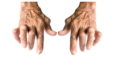 7 أعراض لمرض الروماتيزم.. طرق علاجه