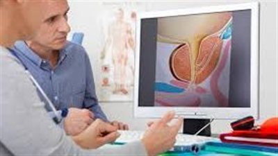 أعراض سرطان البروستاتا.. علامات مزعجة مهمة للرجال