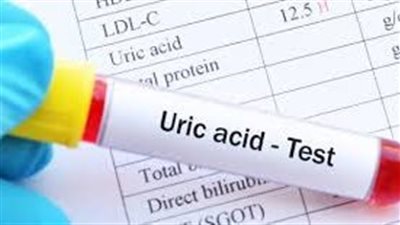 مستويات حمض البوليك الطبيعية لدى الذكور والإناث.. احذر الارتفاع أو الانخفاض