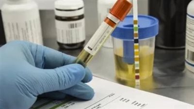 تعديلات اللائحة التنفيذية لقانون المرور: كشف طبي دوري لإثبات اللياقة الصحية للسائقين