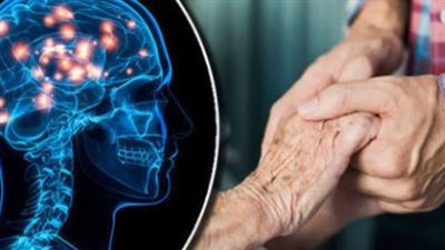 أول علاج ناجح لمرض هنتنغتون: breakthrough طبي يفتح آفاق جديدة