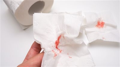 أسباب البراز الدموي.. احذر النزيف الناتج عن هذه الحالات