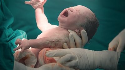 عملية الولادة القيصرية.. ما يحدث ومتى تكون ضرورية؟