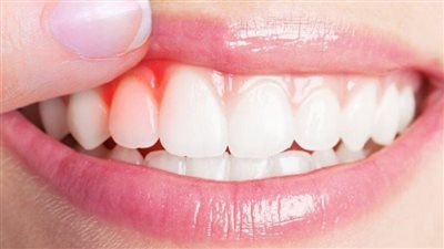طرق تحسين صحة اللثة.. 7 خطوات منزلية مهمة