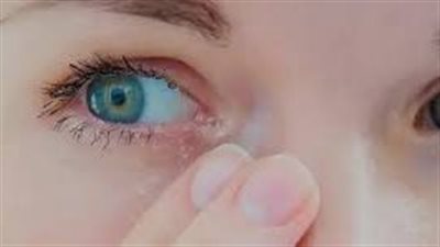 5 طرق فعالة لإيقاف سيلان الدموع