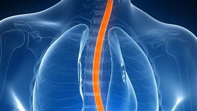 أسباب وأعراض ارتجاع المريء.. آثار جانبية خطيرة في هذه الحالات