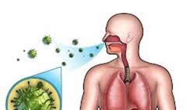 التهاب الشعب الهوائية.. الأنواع والأسباب والأعراض