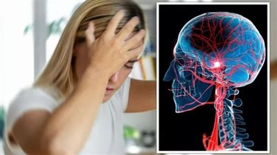 خمسة علامات على الاصابة بسكتة دماغية