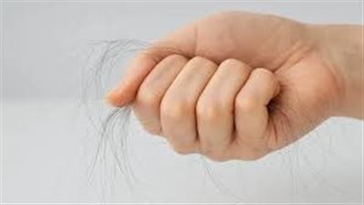 أسباب تساقط الشعر.. كل ما ترغب في معرفته عن الثعلبة