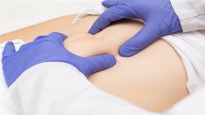 علاج فتق الحجاب الحاجز.. 5 علاجات متاحة لمنع المضاعفات