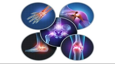 8 حالات صحية تسبب آلام المفاصل تعرف عليها